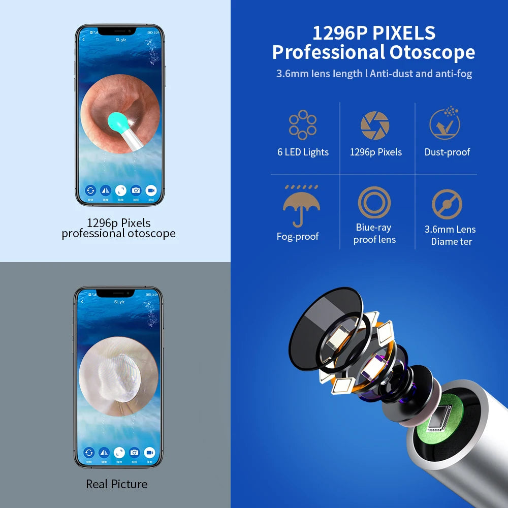 NE3 Limpador de Ouvido // Ferramenta de Remoção de Cera de Ouvido de Alta Precisão // Com Câmera // Luz LED // Otoscópio Sem Fio // Kit de Limpeza de Ouvido Inteligente // Melhor Presente