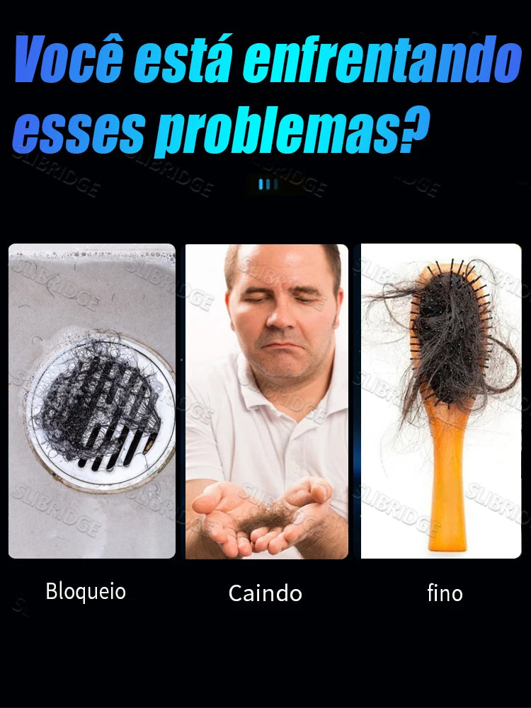 O Condicionador p/ Raízes // Massageia Suavemente o Couro Cabeludo p/ Solucionar Problemas Capilares // Protege a Saúde do Couro Cabeludo. Frete grátis.