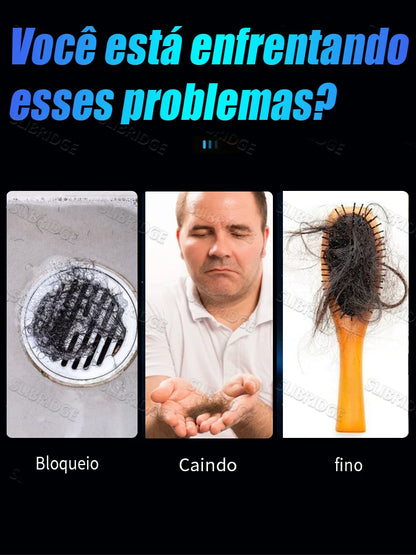 O Condicionador p/ Raízes // Massageia Suavemente o Couro Cabeludo p/ Solucionar Problemas Capilares // Protege a Saúde do Couro Cabeludo. Frete grátis.