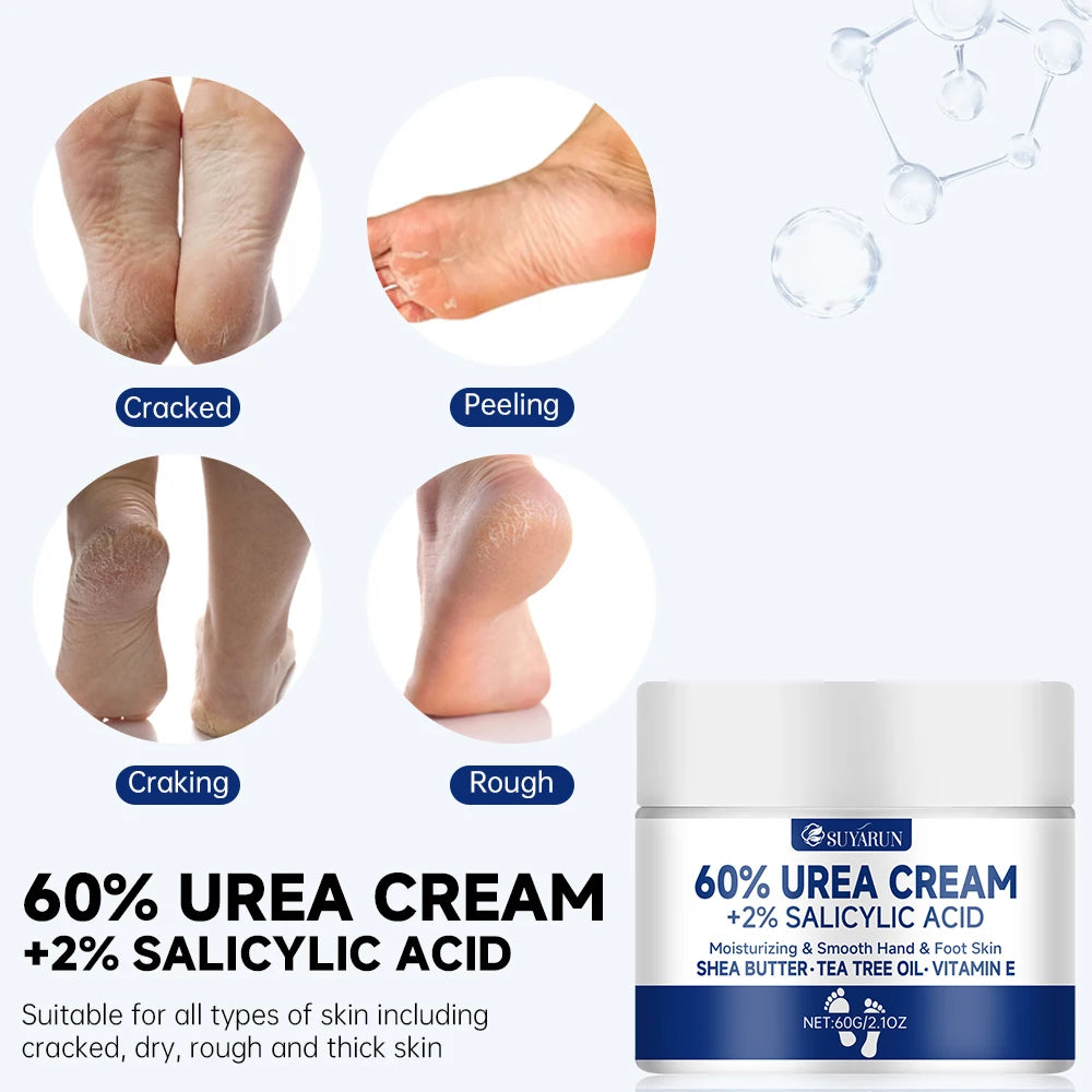 Creme p/ Pés SUYARUN 60% Ureia p/ Calcanhares Rachados e Pele Seca // Tratamento Hidratante Intensivo // Removedor de Calosidades // Cuidado p/ Pés Diabéticos.