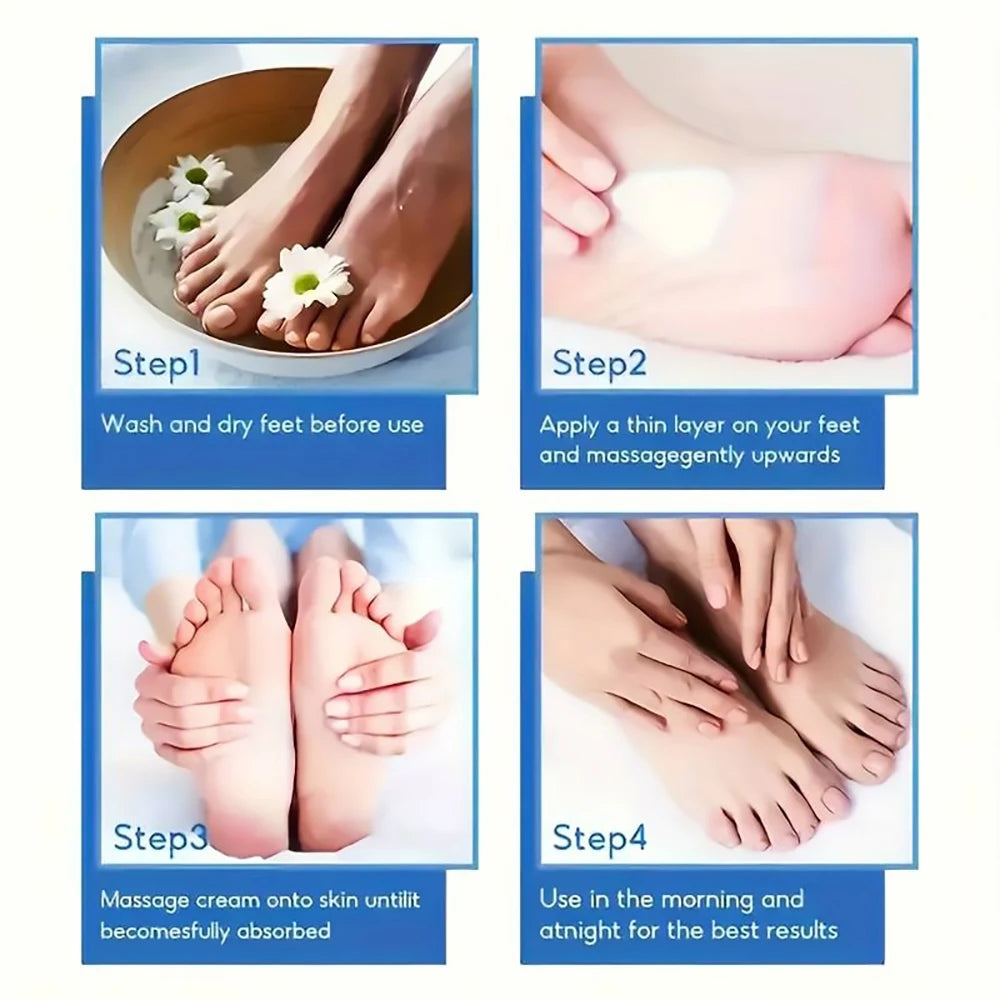 Creme p/ Pés SUYARUN 60% Ureia p/ Calcanhares Rachados e Pele Seca // Tratamento Hidratante Intensivo // Removedor de Calosidades // Cuidado p/ Pés Diabéticos.